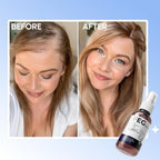 FEG Hair Growth Spray (Pack of 2) with Derma Roller for Men & Women | Hair Regrowth Solution | Free UAE Delivery