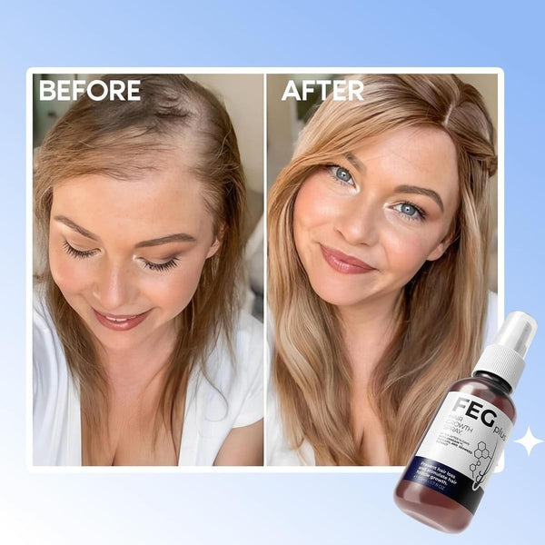 FEG Hair Growth Spray (Pack of 2) with Derma Roller for Men & Women | Hair Regrowth Solution | Free UAE Delivery